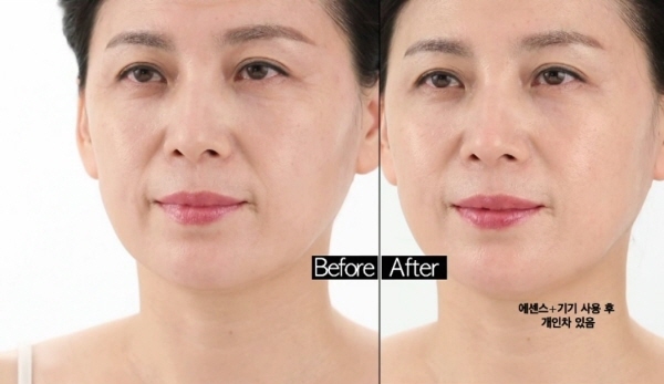 가을철 피부 건조